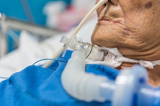 Tracheostomy Care