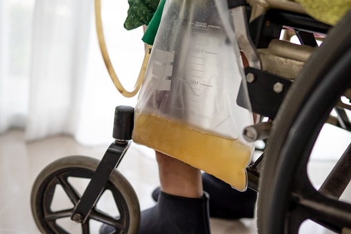 Urinary Catheter Care